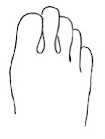 describe foot shape 1