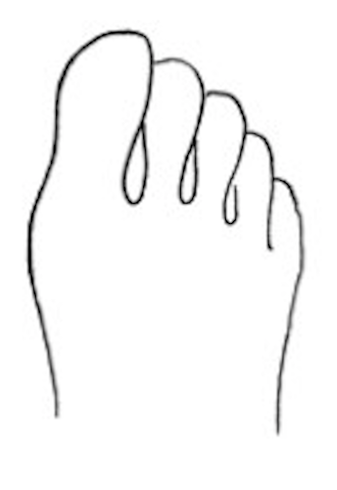 describe foot shape 2