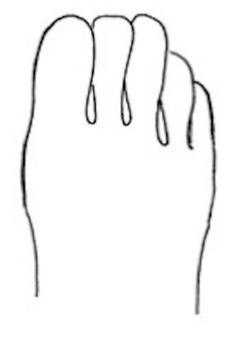 describe foot shape 3